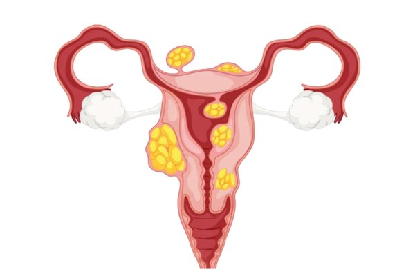 Bir başlık ekleyin (76)