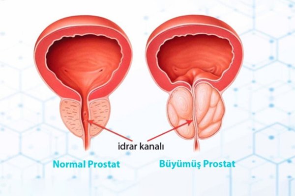 Bir başlık ekleyin (78)